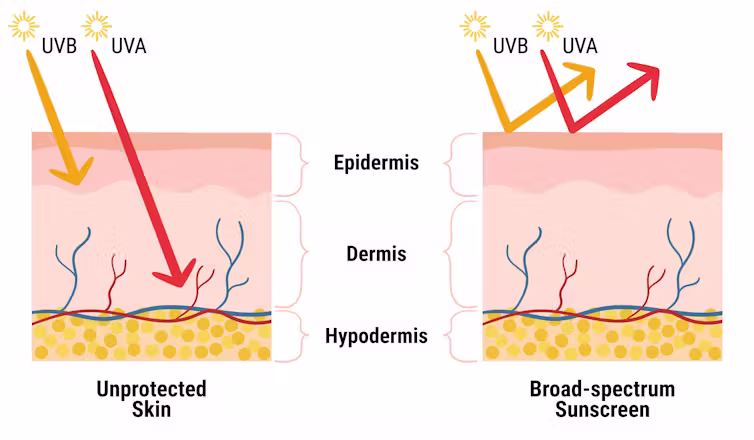A graphic depiction of UVA and UVB rays penetrating the skin and their deflection with sunscreen.